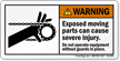Exposed Moving Parts Can Cause Severe Injury Label